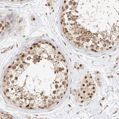 Immunohistochemistry-Paraffin CXorf58 Antibody - BSA Free