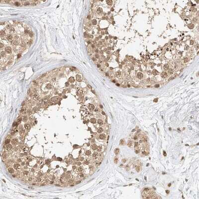 Immunohistochemistry-Paraffin: CXorf58 Antibody [NBP2-48612] - Staining of human testis shows moderate cytoplasmic and nuclear positivity in cells in testis.