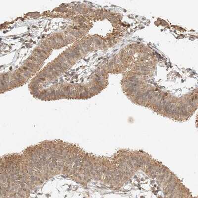 Immunohistochemistry-Paraffin: CXorf58 Antibody [NBP2-48612] - Staining of human Fallopian tube shows moderate cytoplasmic and nuclear positivity in glandular cells.