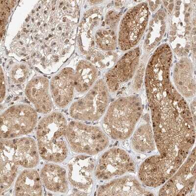 Immunohistochemistry-Paraffin: CXorf58 Antibody [NBP2-48612] - Staining of human Kidney shows moderate nuclear and cytoplasmic positivity in cells in tubules and glomeruli.