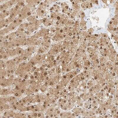 Immunohistochemistry-Paraffin: CXorf58 Antibody [NBP2-48612] - Staining of human Liver shows moderate nuclear and cytoplasmic positivity in hepatocytes.