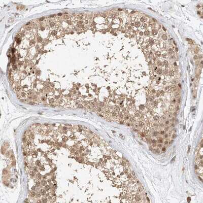 Immunohistochemistry-Paraffin: CXorf58 Antibody [NBP2-48612] - Staining of human Testis shows moderate nuclear and cytoplasmic positivity in cells in seminiferous ducts and leydig cells.