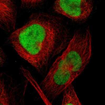 Immunocytochemistry/Immunofluorescence: CXorf67 Antibody [NBP2-47499] - Staining of human cell line U-2 OS shows localization to nucleoplasm. Antibody staining is shown in green.