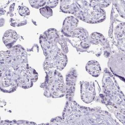 Immunohistochemistry-Paraffin: CXorf67 Antibody [NBP2-47498] - Staining of human placenta shows weak nuclear positivity in trophoblastic cells.
