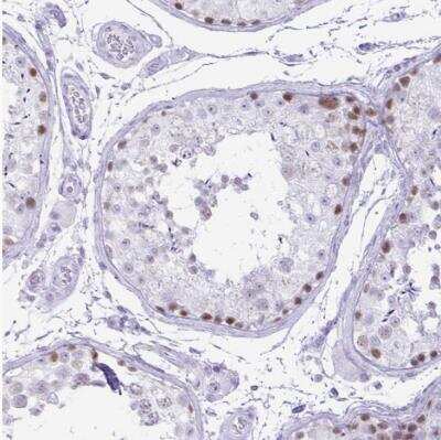 Immunohistochemistry-Paraffin: CXorf67 Antibody [NBP2-47498] - Staining of human testis shows weak to moderate nuclear positivity in cells in seminiferous ducts.