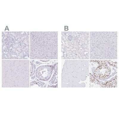 Immunohistochemistry-Paraffin: CXorf67 Antibody [NBP2-47498] - Staining of human kidney, liver, skeletal muscle and testis using Anti-CXorf67 antibody NBP2-47498 (A) shows similar protein distribution across tissues to independent antibody NBP2-47499 (B).