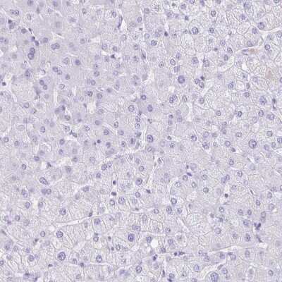 Immunohistochemistry-Paraffin: CXorf67 Antibody [NBP2-47498] - Staining of human liver shows no positivity in hepatocytes as expected.