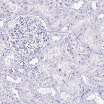 Immunohistochemistry-Paraffin: CXorf67 Antibody [NBP2-47498] - Staining of human kidney shows no positivity in cells in tubules as expected.