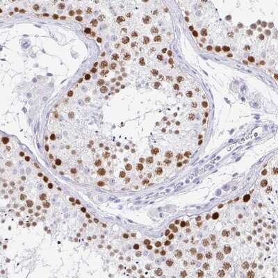 Immunohistochemistry-Paraffin: CXorf67 Antibody [NBP2-47499] - Staining of human testis shows moderate to strong nuclear positivity in cells in seminiferous ducts.