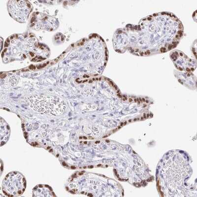 Immunohistochemistry-Paraffin: CXorf67 Antibody [NBP2-47499] - Staining of human placenta shows moderate to strong nuclear positivity in trophoblastic cells.