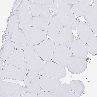 Immunohistochemistry-Paraffin: CXorf67 Antibody [NBP2-47499] - Staining of human skeletal muscle shows no nuclear positivity in myocytes as expected.