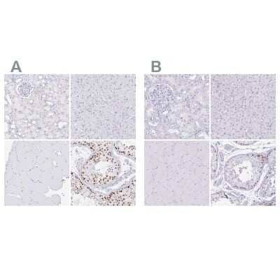 Immunohistochemistry-Paraffin CXorf67 Antibody - BSA Free