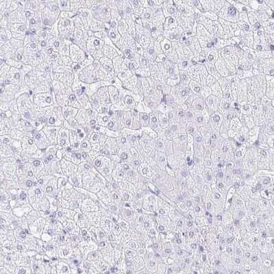 Immunohistochemistry-Paraffin: CXorf67 Antibody [NBP2-47499] - Staining of human liver shows no positivity in hepatocytes as expected.