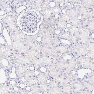 Immunohistochemistry-Paraffin: CXorf67 Antibody [NBP2-47499] - Staining of human kidney shows no positivity in cells in tubules as expected.