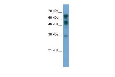 Western Blot: CXorf67 Antibody [NBP2-87231] - WB Suggested Anti-CXorf67 Antibody Titration: 0.2-1 ug/ml. ELISA Titer: 1:312500. Positive Control: Transfected 293T