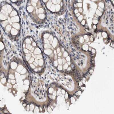 Immunohistochemistry-Paraffin: CYB561 Antibody [NBP1-83422] - Staining of human colon shows moderate cytoplasmic positivity in glandular cells.