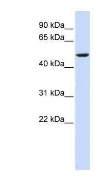 Western Blot: CYB561 Antibody [NBP1-60118] - Titration: 0.2-1 ug/ml, Positive Control: Hela cell lysate.