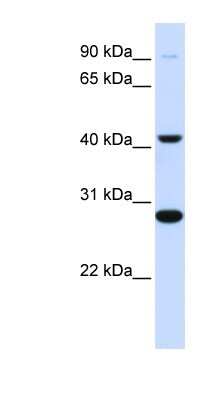 Western Blot: CYB561 Antibody [NBP1-62715] - Titration: 0.2-1 ug/ml, Positive Control: Human Muscle.