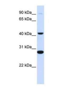 Western Blot: CYB561 Antibody [NBP1-69701] - This Anti-CYB561 antibody was used in Western Blot of Fetal Muscle tissue lysate at a concentration of 1ug/ml.