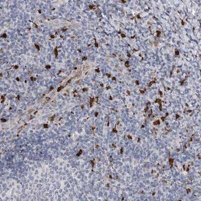 Immunohistochemistry-Paraffin: CYB561D1 Antibody [NBP1-83468] - Staining of human tonsil shows strong cytoplasmic positivity in subsets of lymphoid cells.
