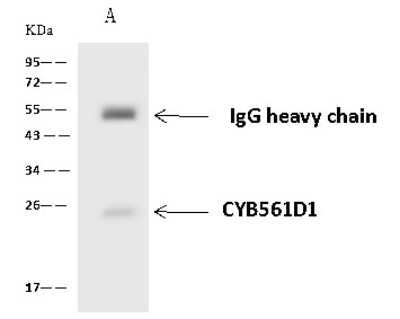 Immunoprecipitation: CYB561D1 Antibody [NBP2-98672] - CYB561D1 was immunoprecipitated using: Lane A: 0.5 mg Hela Whole Cell Lysate 4 ul anti-CYB561D1 rabbit polyclonal antibody and 60 ug of Immunomagnetic beads Protein A/G.  Primary antibody: Anti-CYB561D1 rabbit polyclonal antibody, at 1:100 dilution. Secondary antibody: Goat Anti-Rabbit IgG (H+L)/HRP at 1/10000 dilution. Developed using the ECL technique. Performed under reducing conditions. Predicted band size: 25 kDa. Observed band size: 25 kDa