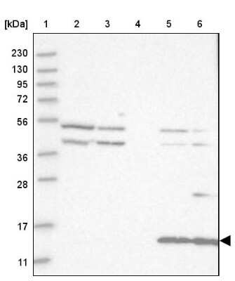 Western Blot: CYB561D1 Antibody [NBP1-83468] - Lane 1: Marker  [kDa] 230, 130, 95, 72, 56, 36, 28, 17, 11.  Lane 2: Human cell line RT-4.  Lane 3: Human cell line U-251MG sp.  Lane 4: Human plasma (IgG/HSA depleted).  Lane 5: Human liver tissue.  Lane 6: Human tonsil tissue