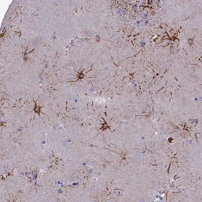 Immunohistochemistry-Paraffin: CYB561D2 Antibody [NBP1-89415] - Staining of human lateral ventricle shows strong cytoplasmic positivity in fraction of glial cells.