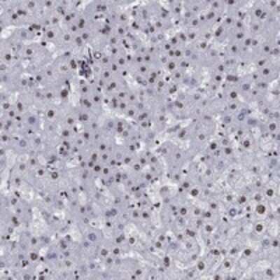 Immunohistochemistry-Paraffin CYB561D2 Antibody - BSA Free