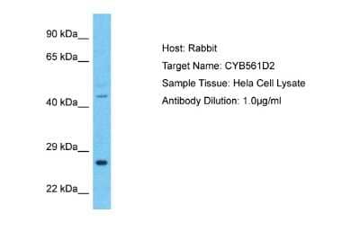 Western Blot: CYB561D2 Antibody [NBP2-84743] - Host: Rabbit. Target Name: CYB561D2. Sample Type: Hela Whole Cell lysates. Antibody Dilution: 1.0ug/ml
