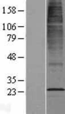 Western Blot: CYB561D2 Overexpression Lysate (Adult Normal) [NBL1-09650] Left-Empty vector transfected control cell lysate (HEK293 cell lysate); Right -Over-expression Lysate for CYB561D2.