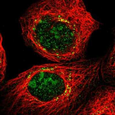Immunocytochemistry/Immunofluorescence: CYB5D1 Antibody [NBP1-83529] - Immunofluorescent staining of human cell line A-431 shows localization to nucleoli & the Golgi apparatus.