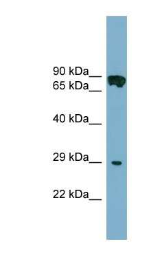 Western Blot: CYB5D1 Antibody [NBP1-56361] - COLO205 cells lysate, concentration 0.2-1 ug/ml.