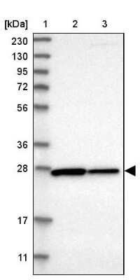 Western Blot: CYB5D1 Antibody [NBP1-83529] - Lane 1: Marker  [kDa] 230, 130, 95, 72, 56, 36, 28, 17, 11.  Lane 2: Human cell line RT-4.  Lane 3: Human cell line U-251MG sp