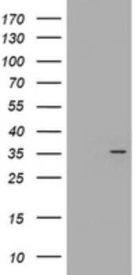 Western Blot: CYB5R1 Antibody (2D10) [NBP2-45649] - Analysis of HEK293T cells were transfected with the pCMV6-ENTRY control (Left lane) or pCMV6-ENTRY CYB5R1.