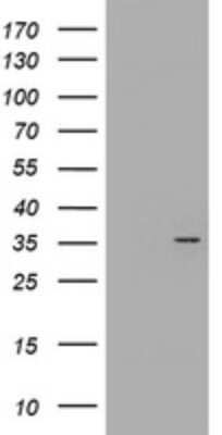 Western Blot: CYB5R1 Antibody (2D10) [NBP2-45649] - Analysis of HEK293T cells were transfected with the pCMV6-ENTRY control (Left lane) or pCMV6-ENTRY CYB5R1.