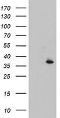 Western Blot CYB5R1 Antibody (OTI4B7)