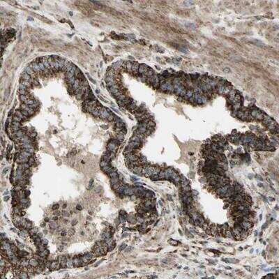 Immunohistochemistry-Paraffin: CYB5R1 Antibody [NBP1-83145] - Staining of human prostate shows strong granular cytoplasmic positivity in glandular cells.