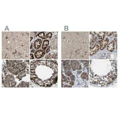 <b>Independent Antibodies Validation. </b>Immunohistochemistry-Paraffin: CYB5R1 Antibody [NBP1-83145] - Staining of human cerebral cortex, kidney, pancreas and testis using Anti-CYB5R1 antibody NBP1-83145 (A) shows similar protein distribution across tissues to independent antibody NBP1-83144 (B).