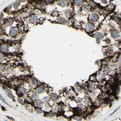 Immunohistochemistry-Paraffin CYB5R1 Antibody - BSA Free