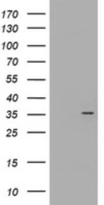 Western Blot: CYB5R1 Antibody (OTI2D10) - Azide and BSA Free [NBP2-71946] - Analysis of HEK293T cells were transfected with the pCMV6-ENTRY control (Left lane) or pCMV6-ENTRY CYB5R1.