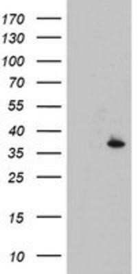 Western Blot: CYB5R1 Antibody (OTI4B7) - Azide and BSA Free [NBP2-71943] - HEK293T cells were transfected with the pCMV6-ENTRY control (Left lane) or pCMV6-ENTRY CYB5R1 (Right lane) cDNA for 48 hrs and lysed. Equivalent amounts of cell lysates (5 ug per lane) were separated by SDS-PAGE and immunoblotted with anti-CYB5R1.