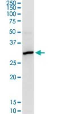 Western Blot: CYB5R1 Antibody [H00051706-D01P] - Analysis of CYB5R1 expression in human placenta.