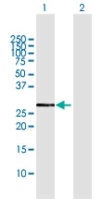Western Blot: CYB5R1 Antibody [H00051706-D01P] - Analysis of CYB5R1 expression in transfected 293T cell line by CYB5R1 polyclonal antibody.Lane 1: CYB5R1 transfected lysate(34.10 KDa).Lane 2: Non-transfected lysate.