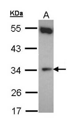 Western Blot: CYB5R1 Antibody [NBP1-32276] - Sample (30 ug of whole cell lysate) A: Hela10% SDS PAGE, antibody diluted at 1:500.