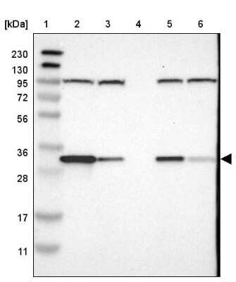 <b>Independent Antibodies Validation. </b>Western Blot: CYB5R1 Antibody [NBP1-83144] - Lane 1: Marker  [kDa] 230, 130, 95, 72, 56, 36, 28, 17, 11.  Lane 2: Human cell line RT-4.  Lane 3: Human cell line U-251MG sp.  Lane 4: Human plasma (IgG/HSA depleted).  Lane 5: Human liver tissue.  Lane 6: Human tonsil tissue