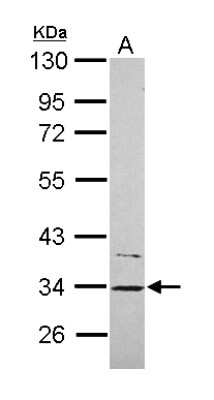 Western Blot: CYB5R1 Antibody [NBP2-16047] - Sample (30 ug of whole cell lysate) A: Hep G2 10% SDS PAGE gel, diluted at 1:1000.