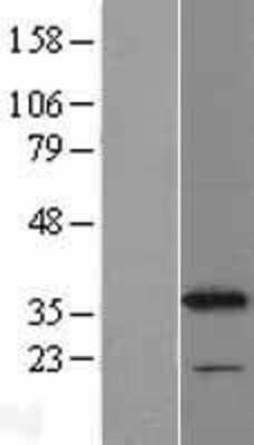 Western Blot: CYB5R1 Overexpression Lysate (Adult Normal) [NBL1-09653] Left-Empty vector transfected control cell lysate (HEK293 cell lysate); Right -Over-expression Lysate for CYB5R1.