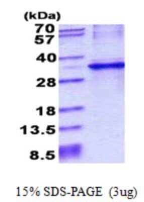 SDS-PAGE Recombinant Human CYB5R1 His Protein