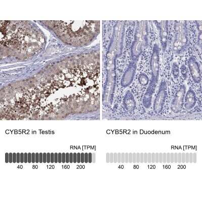 <b>Orthogonal Strategies Validation. </b>Immunohistochemistry-Paraffin: CYB5R2 Antibody [NBP2-62636] - Immunohistochemistry analysis in human testis and duodenum tissues using Anti-CYB5R2 antibody. Corresponding CYB5R2 RNA-seq data are presented for the same tissues.