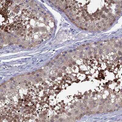 Immunohistochemistry-Paraffin CYB5R2 Antibody - BSA Free
